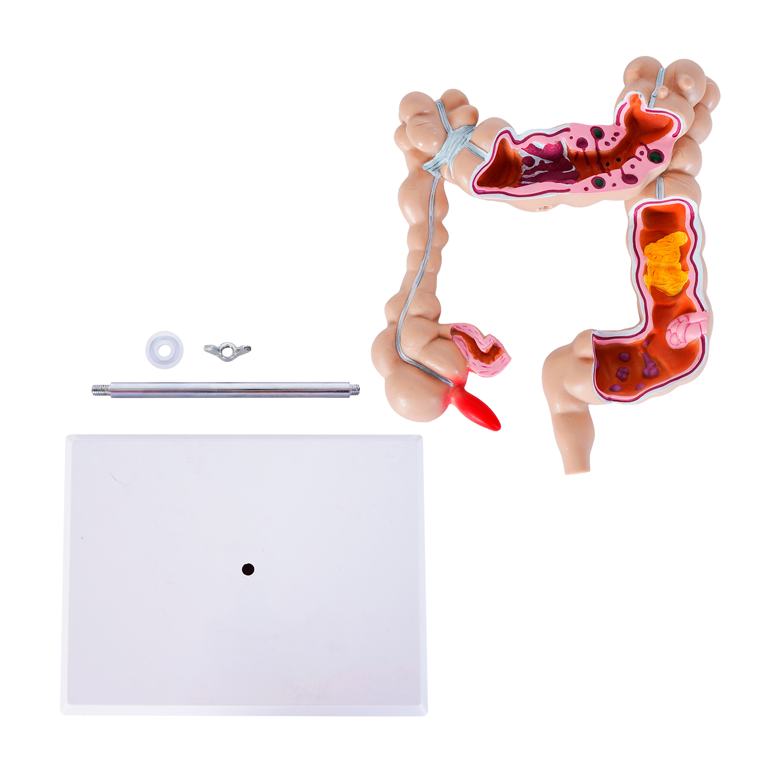 COLON personalizado